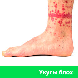 Укус блохи